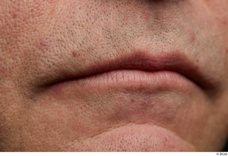  HD Face skin references Saahir Nasir lips mouth pores skin texture 0004.jpg